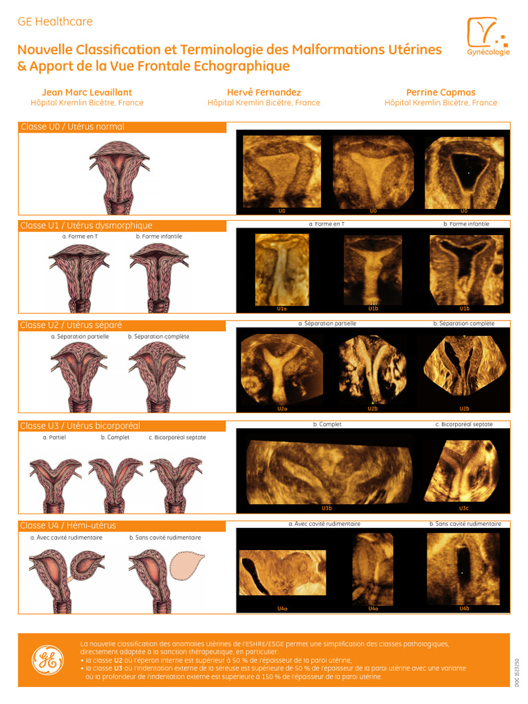 Classification des Malformations Utérines | PDF | Utérus | Système ...