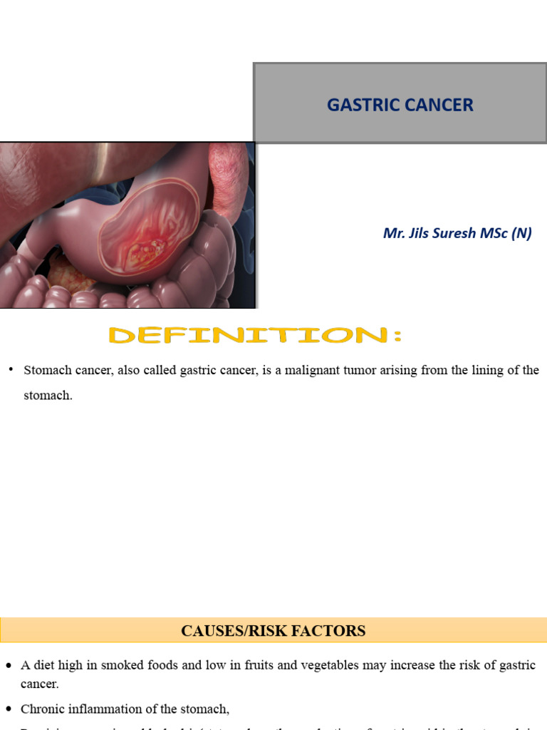 Gastric Cancer Pdf Cancer Indigestion