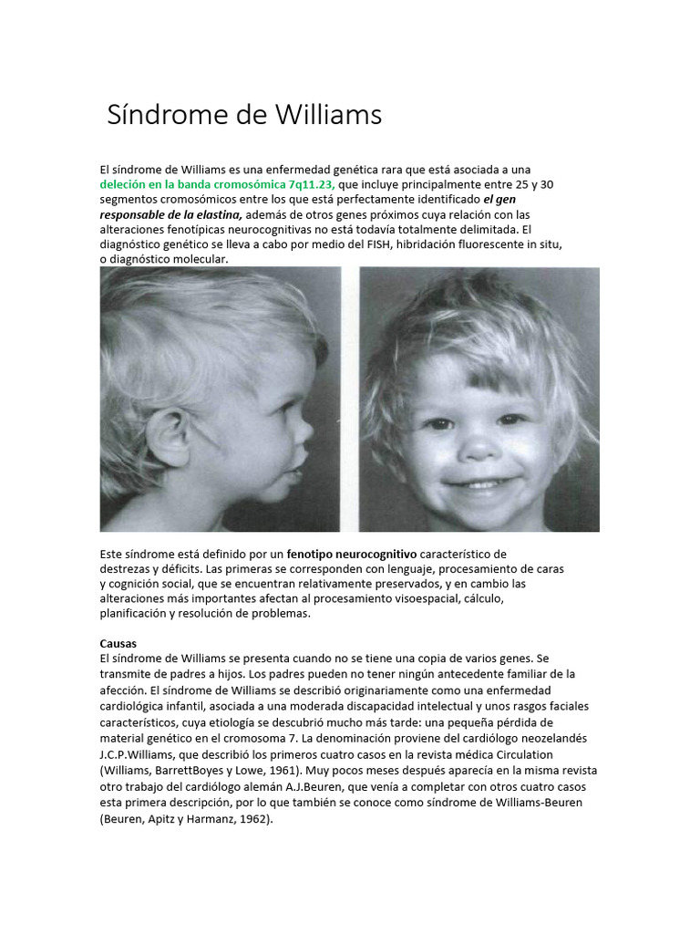 Síndrome de Williams | PDF | Palabra | Memoria