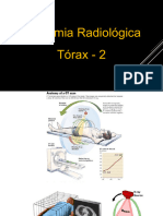 Anatomia Radiologica - Tórax I