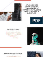 Wepik Aplicaciones Clinicas de La Tomografia de Craneo Patologias Mas Comunes y Ejemplos 20240328164535WUvk