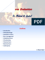 Burns Evaluation: Dr. Mahmoud W. Qandeel