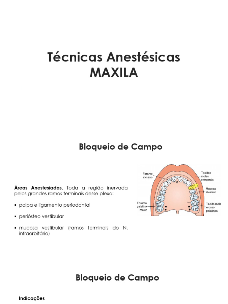 Técnicas de Anestesia Dental Maxilar e Mandibular | PDF | Dente humano ...