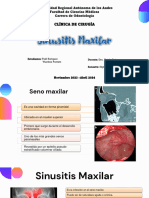 Sinusitis Maxilar