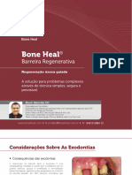 Regeneração Óssea Guiada - Bone Heal - Barreira-Regenerativa - Salomão, M