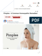 Pimples - 6 Common Homeopathic Remedies! - by Dr. Jagat Shah - Lybrate