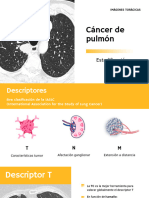 Cancer de Pulmon Estadificacion