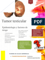 Tumor Testicular e Hidrocele