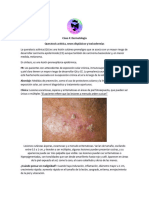 Queratosis Actínica, Nevos Displásicos y Toxicodermias (Exanetema Morbiliforme, SJ y NET)