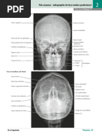 Atlas de radioanatomie du rocher | PDF | Anatomie | Sens (physiologie)