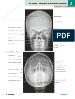 Tête Osseuse Radiographie de Face (Antéro-Postérieure)