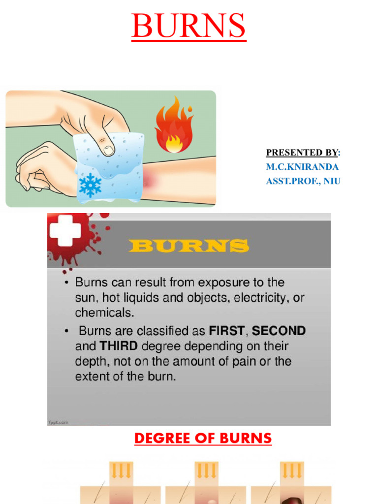 Rule of Nines for Burn Assessment | PDF