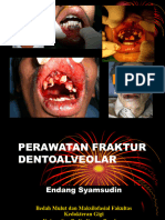Poltekes-fraktur Dentoalveolar -April 2024