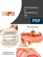 Enfermedad Diverticular