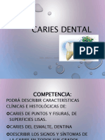 Caries dental 1 [Autoguardado] (1)