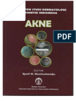 AKNE