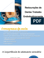 Restaurações de Dentes Tratados Endodonticamente - 2023