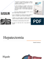 Hepatectomía