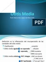 Otitis media aguda