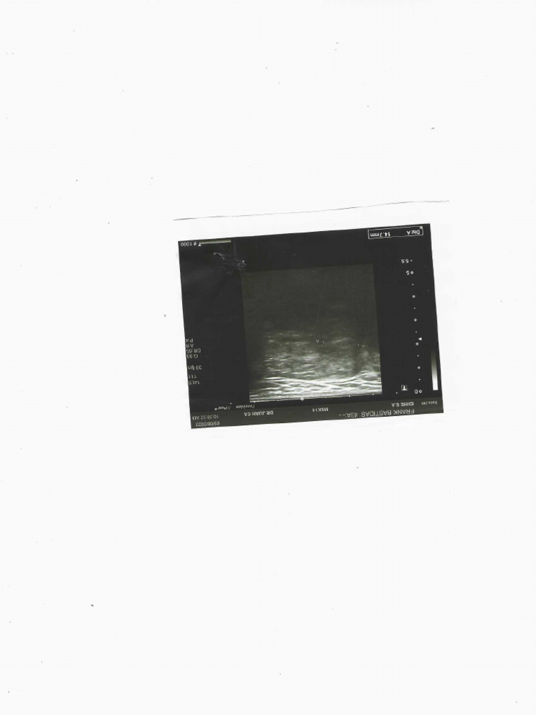 Scan pdf