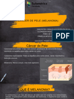 Câncer de Pele Melanoma