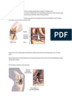 Apa Itu Ligamen Anterior