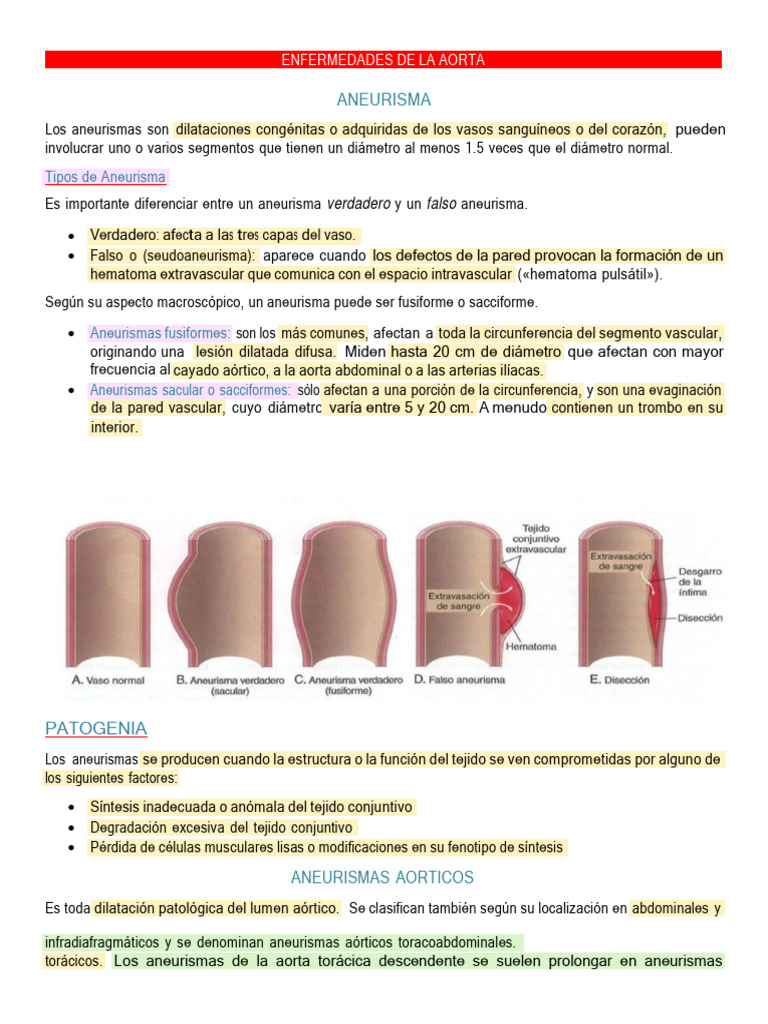 Enfermedades y Aneurismas de la Aorta | PDF | Aorta | Aterosclerosis