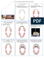 Design sequence partial dentures  F Sutton_compressed