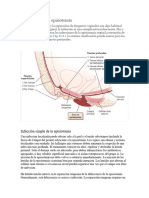 Infecciones de La Episiotomía