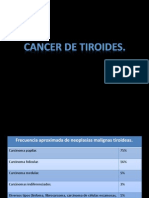 Cancer de Tiroides
