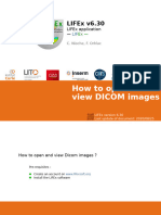 LIFEx Tutorials How To Open and View Dicom Images