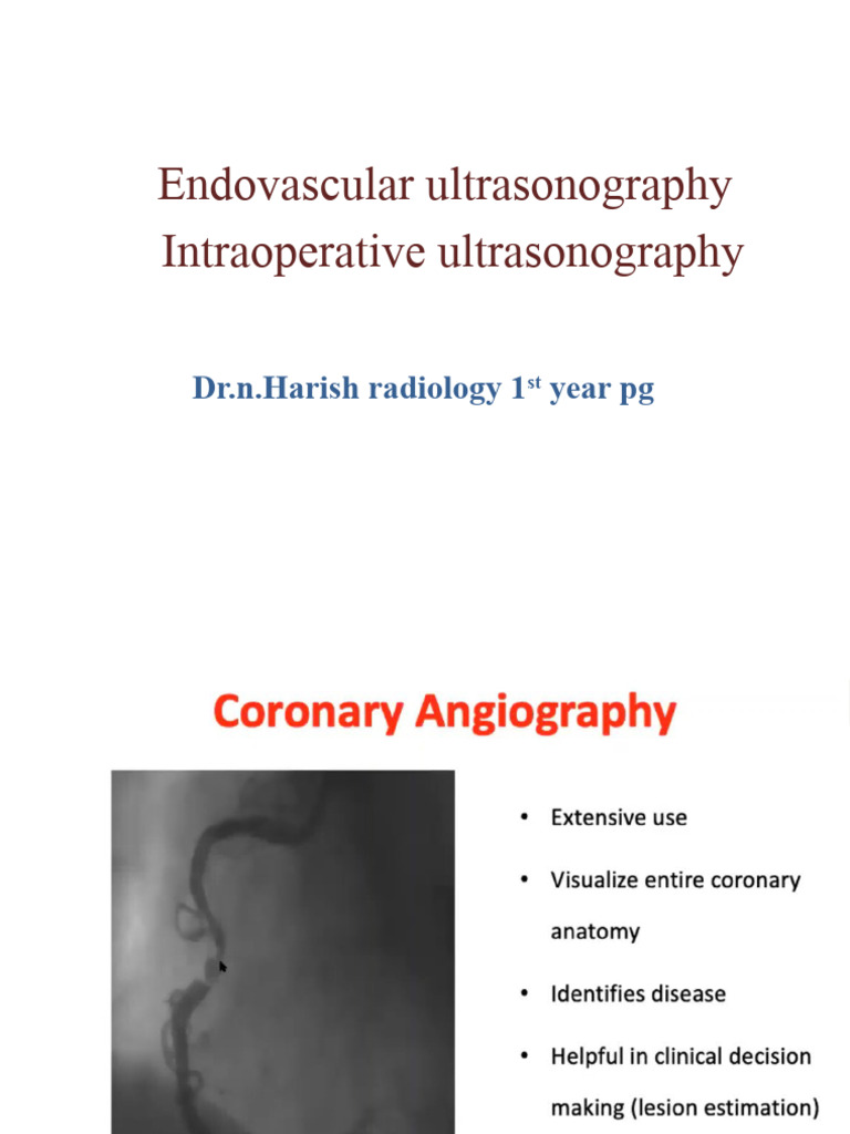 Ivus | PDF | Medical Ultrasound | Medical Imaging