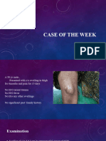 Case of The Week - Spindle Cell