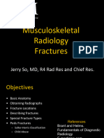 MSK Fractures - J So