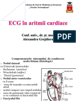 Aritmiile Cardiace Varianta Scurtă