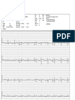 Midmark Diagnostics Group: I aVR V1 V4