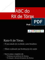 04 - ABC Do RX de Tórax