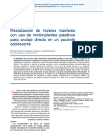 Maxillary Molar Mesialization With The Use of Palatal Mini-Implants For Direct Anchorage in An Adolescent Patient Es