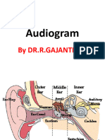 Audiogram-2