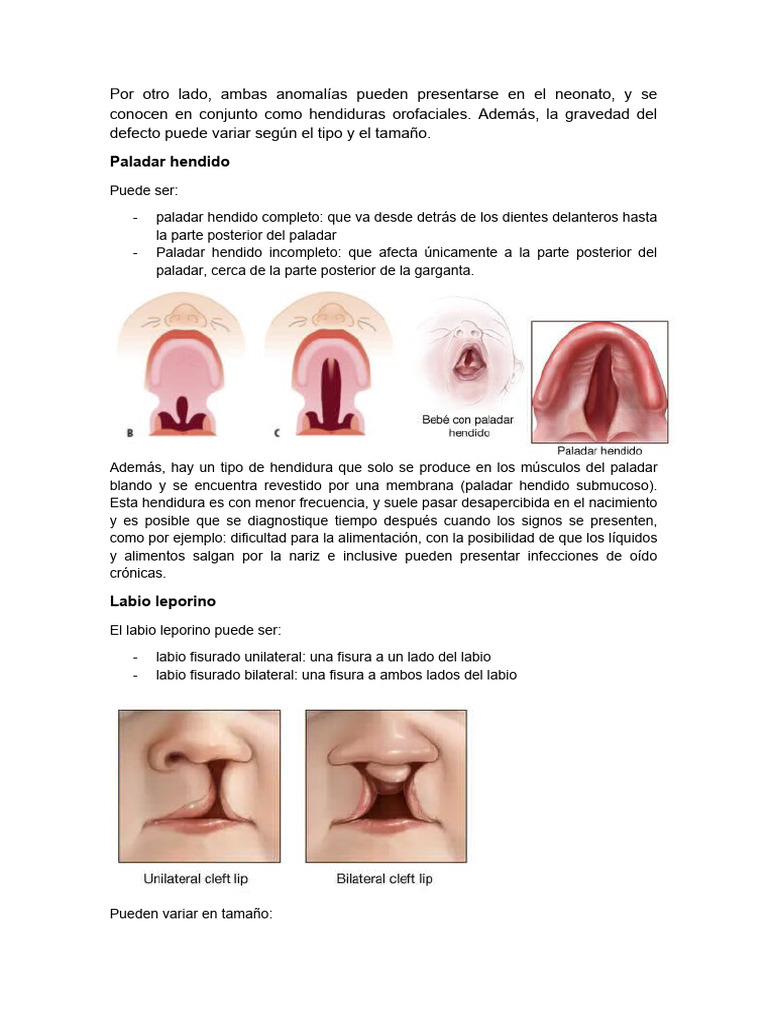 Anatomía Del Paladar Hendido