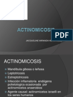 ACTINOMICOSIS