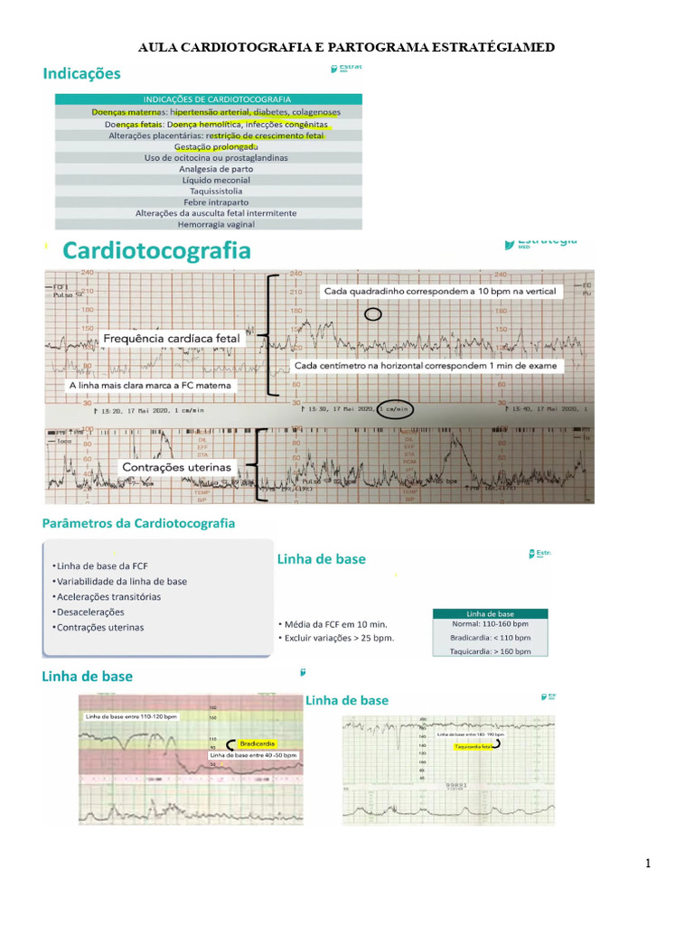 Interpretação de Cardiotocografia | PDF