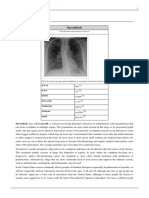 Sarcoidosis