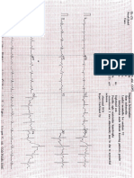 ECG