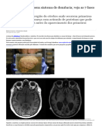 Alzheimer Começa Sem Sintoma de Demência