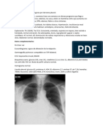 01.caso DERRAME PLEURAL