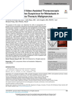 Microcoil-Guided Video-Assisted Thoracoscopic