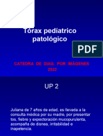 Torax Pediatria Patologico
