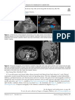 Woman With Leg Edema - Ymem