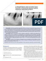 2013 - Holtzclaw - Amnion Chorion Allograft Barrier Used For Guided Tissue Regeneration Treatment